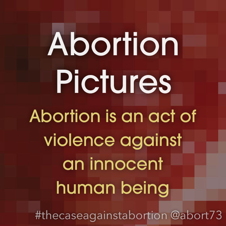 Abortion Pictures: Abortion is an act of violence against an innocent human being.