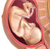 24 week fetus