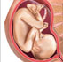 28 week fetus