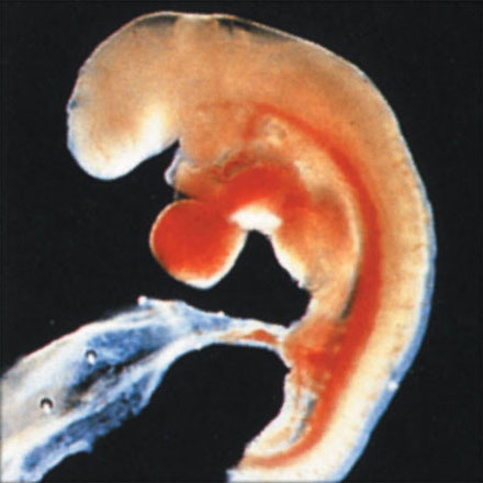 4 week embryo