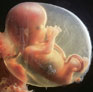 15 week fetus